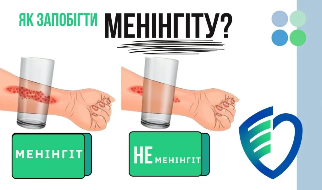 symptomy-meninhitu-u-ditei-koly-ne-mozhna-chekaty-31c0